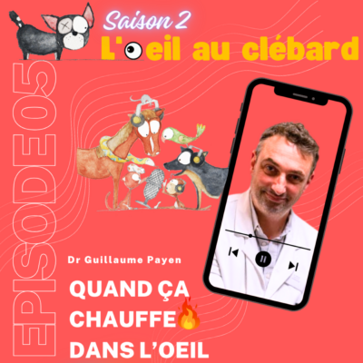 Quand ça chauffe dans l’oeil