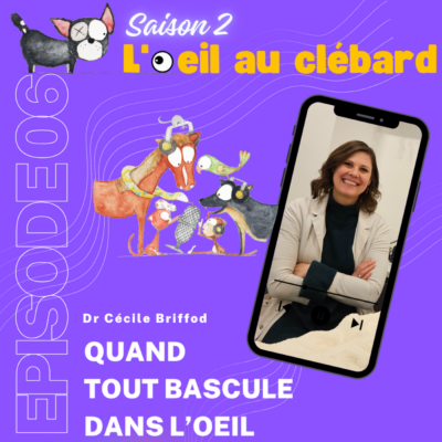 Quand tout bascule dans l’oeil