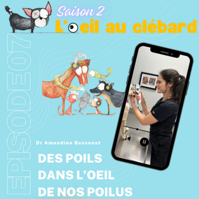 Des poils dans l’oeil de nos poilus