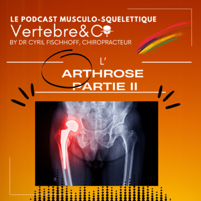 Tout sur l’Arthrose ! (Partie 2)